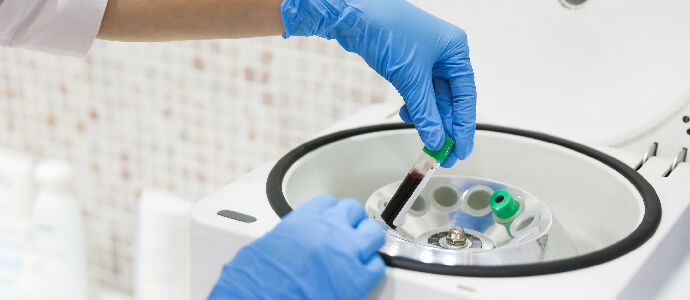 the doctor's hands place a test tube of blood in the centrifuge, Biosimilars